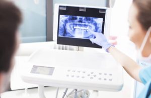 Scanner intra oral dentiste Lyon